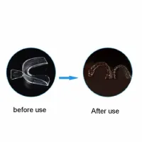 Anti Snoring Mouth Guard Set thumbnail 5