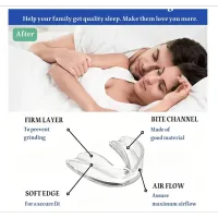4-Pack Moldable Teeth Night Guards thumbnail 2