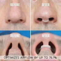 Anti Snoring Nose Clip Set (1-4 Pcs) thumbnail 2