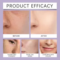 Retinol Serum with Hyaluronic Acid & Vitamin C thumbnail 3