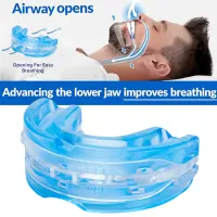 Anti Snoring & Bruxism Mouth Guard thumbnail 2