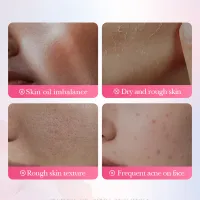 SADOER Sakura Salicylic Acid Face Mask thumbnail 3