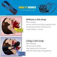 Anti Snore Chin Strap - Sleep Aid thumbnail 2