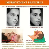 Anti-Snoring Mouth Breathing Correction Band thumbnail 5