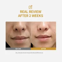 Peptide Lifting Ampoule Serum thumbnail 4