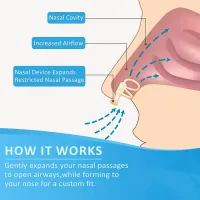 Snore Stopper Nasal Dilator thumbnail 4