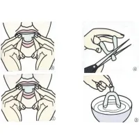 Anti Snoring Mouth Guard Set thumbnail 6