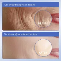 SADOER Caviar Hyaluronic Acid Face Masks (10pcs) thumbnail 5