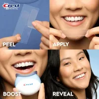 Professional Teeth Whitening Kit with LED thumbnail 5