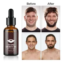 Complete Beard Growth Kit for Men thumbnail 5