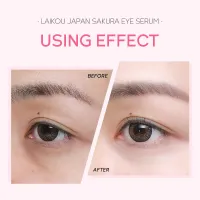 Sakura Eye Massage Cream with Slide Ball thumbnail 3