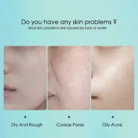 Hyaluronic Acid Hydrating Face Masks thumbnail 3