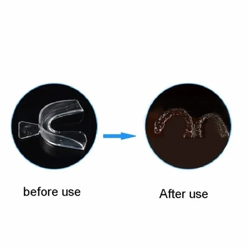 Anti Snoring Mouth Guard Set 5