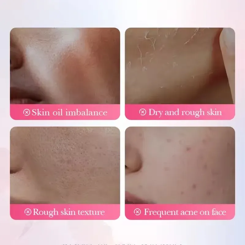 SADOER Sakura Salicylic Acid Face Mask 3