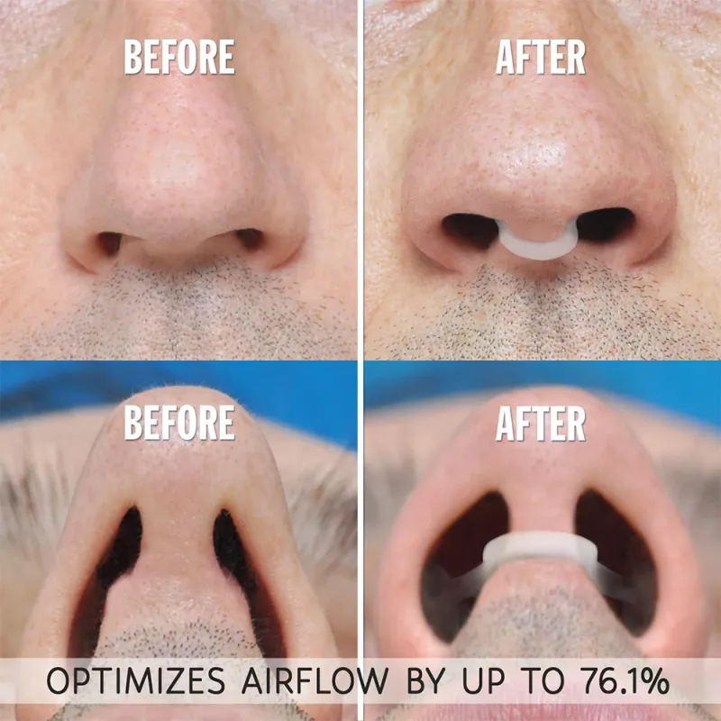 Anti Snoring Nose Clip Set (1-4 Pcs) 2