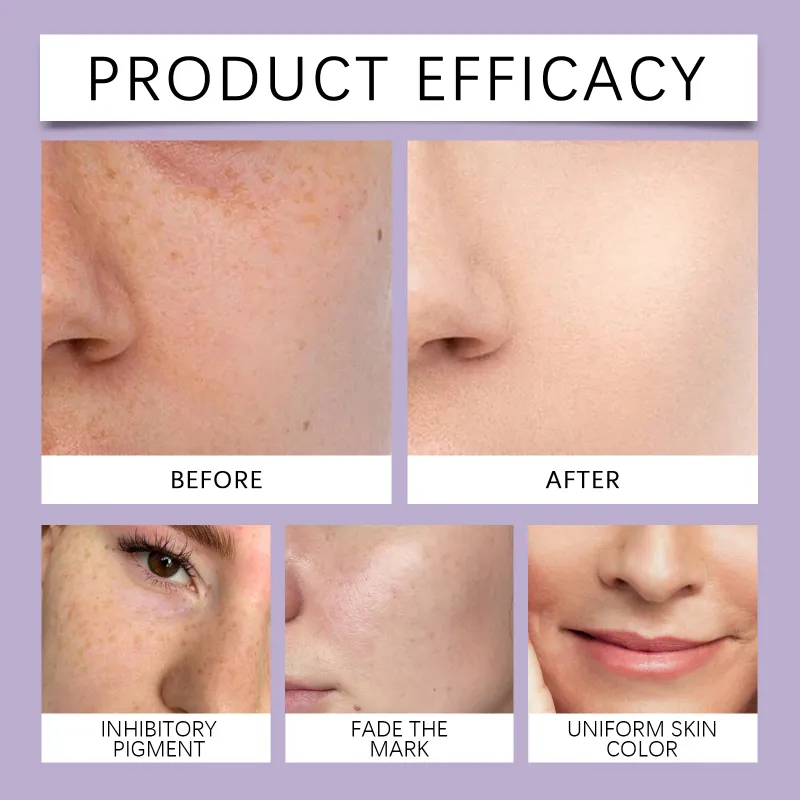 Retinol Serum with Hyaluronic Acid & Vitamin C 3