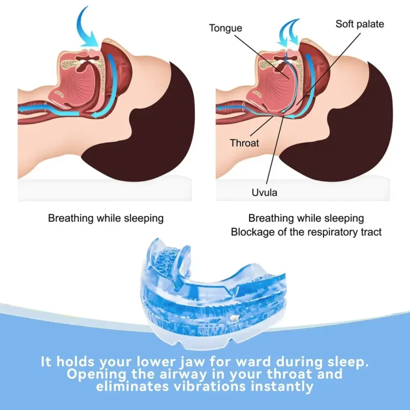 Adjustable Anti-Snoring Mouth Guard 3