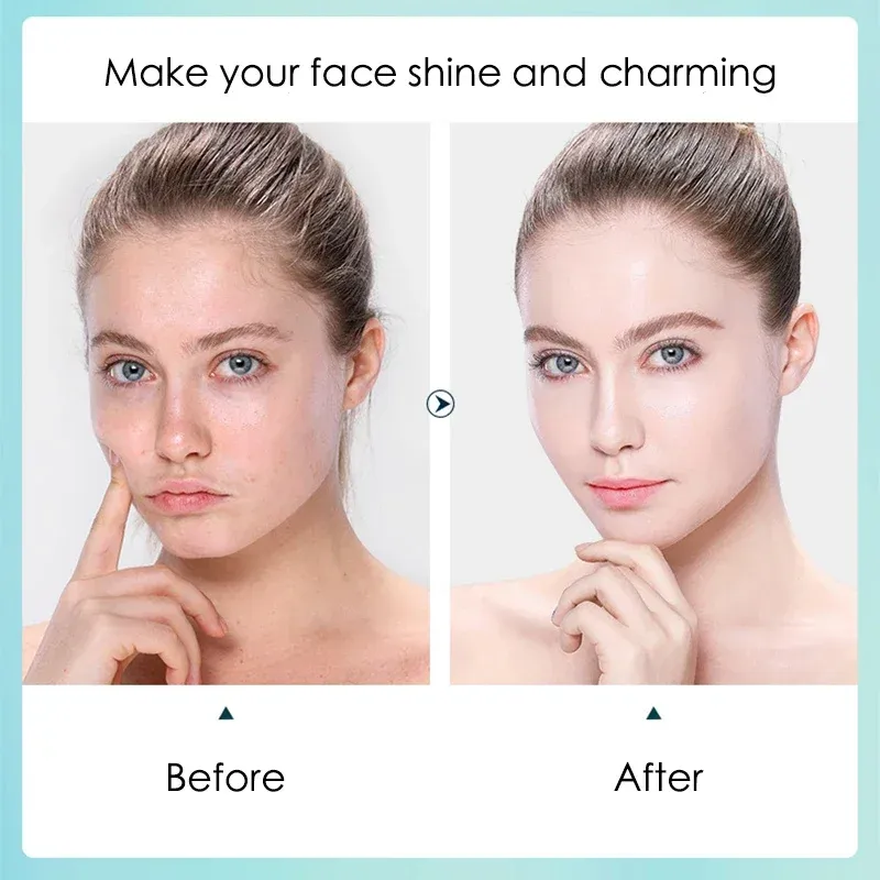 Hyaluronic Acid Hydrating Face Masks 4