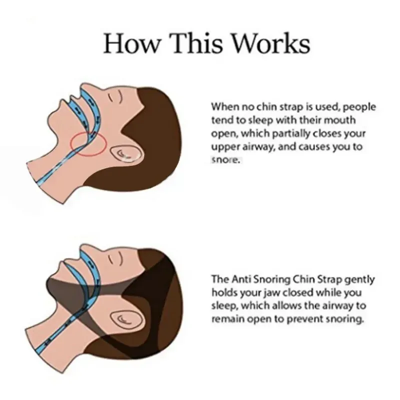 Anti Snoring Chin Support Belt 5