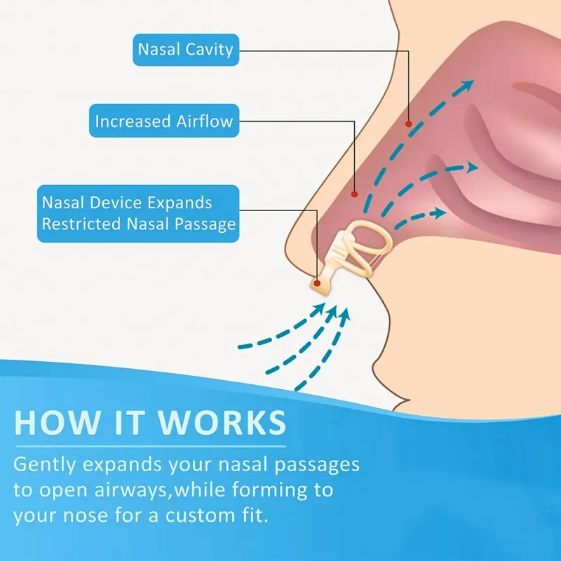 Snore Stopper Nasal Dilator 4