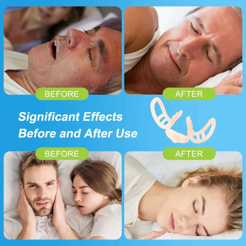 Snore Stopper Nasal Dilator 6