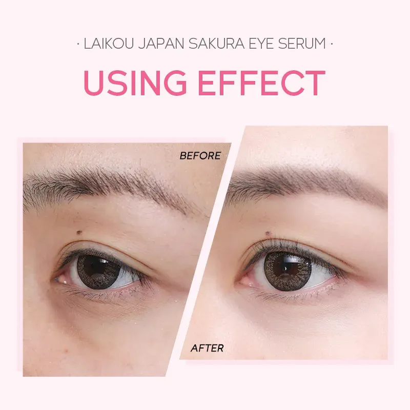 LAIKOU Sakura Vitamin C Eye Serum Roller 2