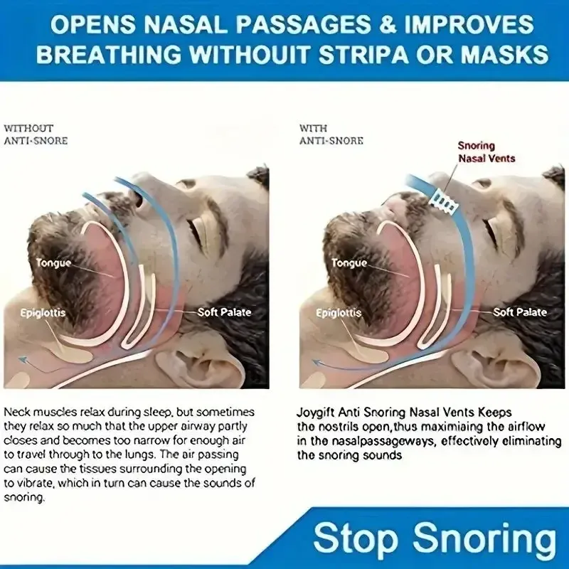 Anti Snoring Nasal Dilator 5
