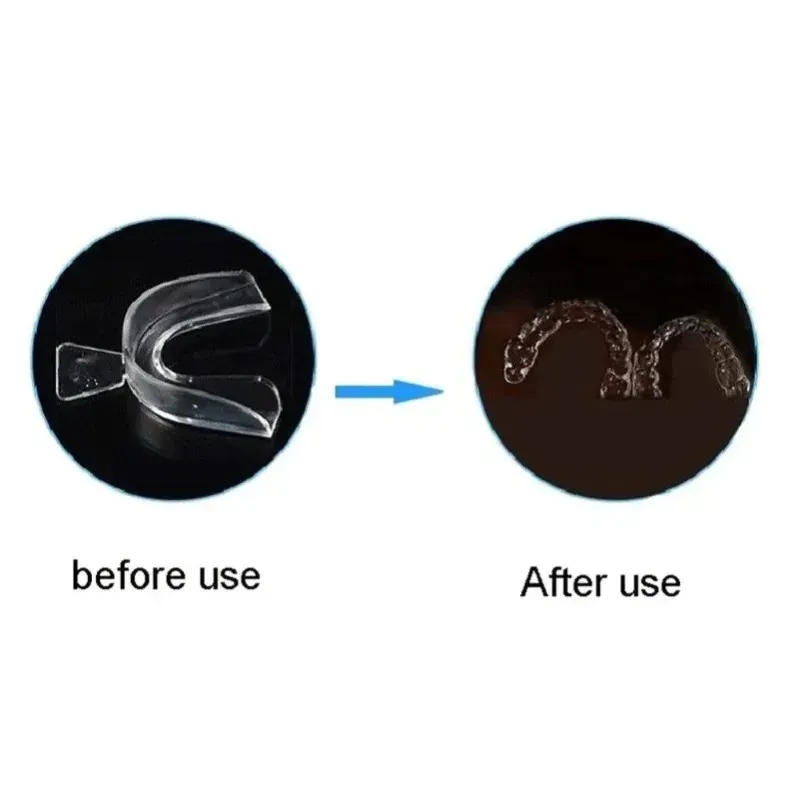 Anti Snoring & Teeth Grinding Mouth Guard 4